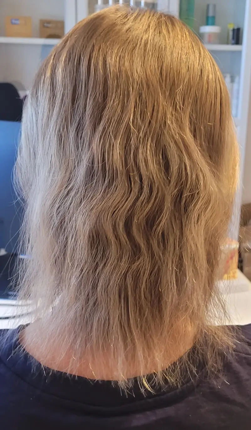 Skrócony anagen — poprawa gęstości i objętości włosów w trakcie terapii