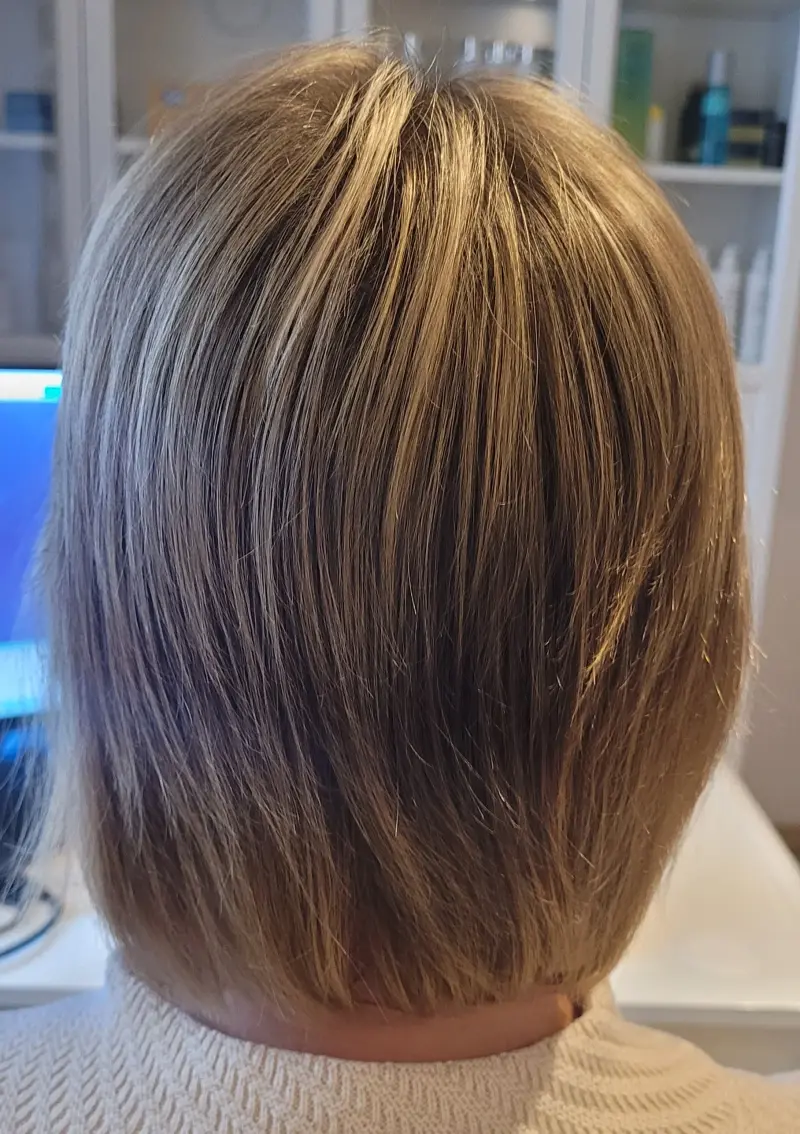 Łysienie telogenowe — zagęszczenie i poprawa struktury włosów po terapii